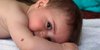 5 Fakta Tentang Tanda Lahir pada Bayi yang Perlu Moms Tahu