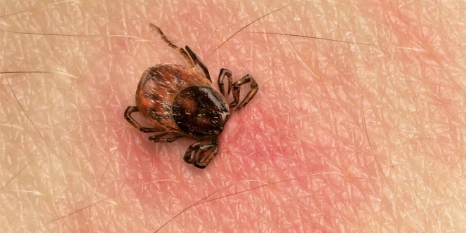 Berikut yang Harus Kamu Ketahui Tentang Penyakit Lyme