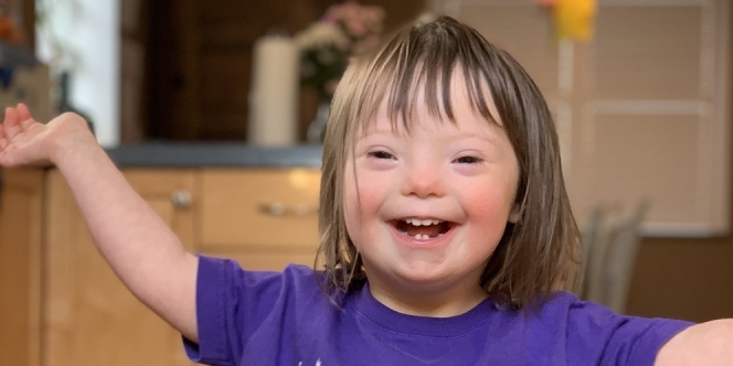 Penyebab Down Syndrome Menurut Para Ahli yang Terjadi pada Anak