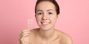 7 Rekomendasi Acne Patch Terbaik Untuk Atasi Jerawat Membandel