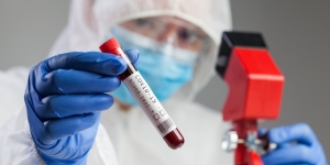WHO Temukan Varian Virus Corona Baru Bernama 'Mu'